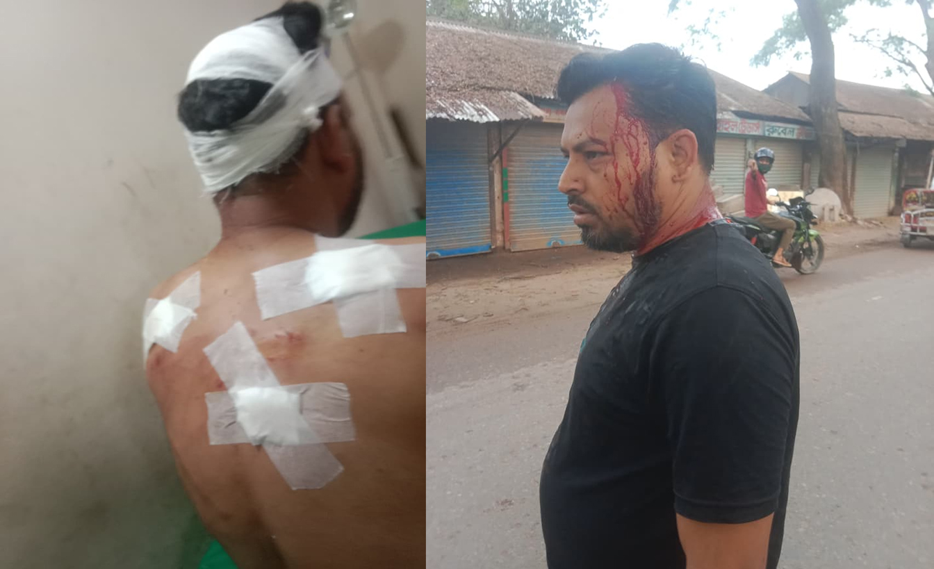 মুরাদনগরে কিশোরীকে অপহরণের চেষ্টা, বাধাঁ দেয়ায় মামাকে মারধর
