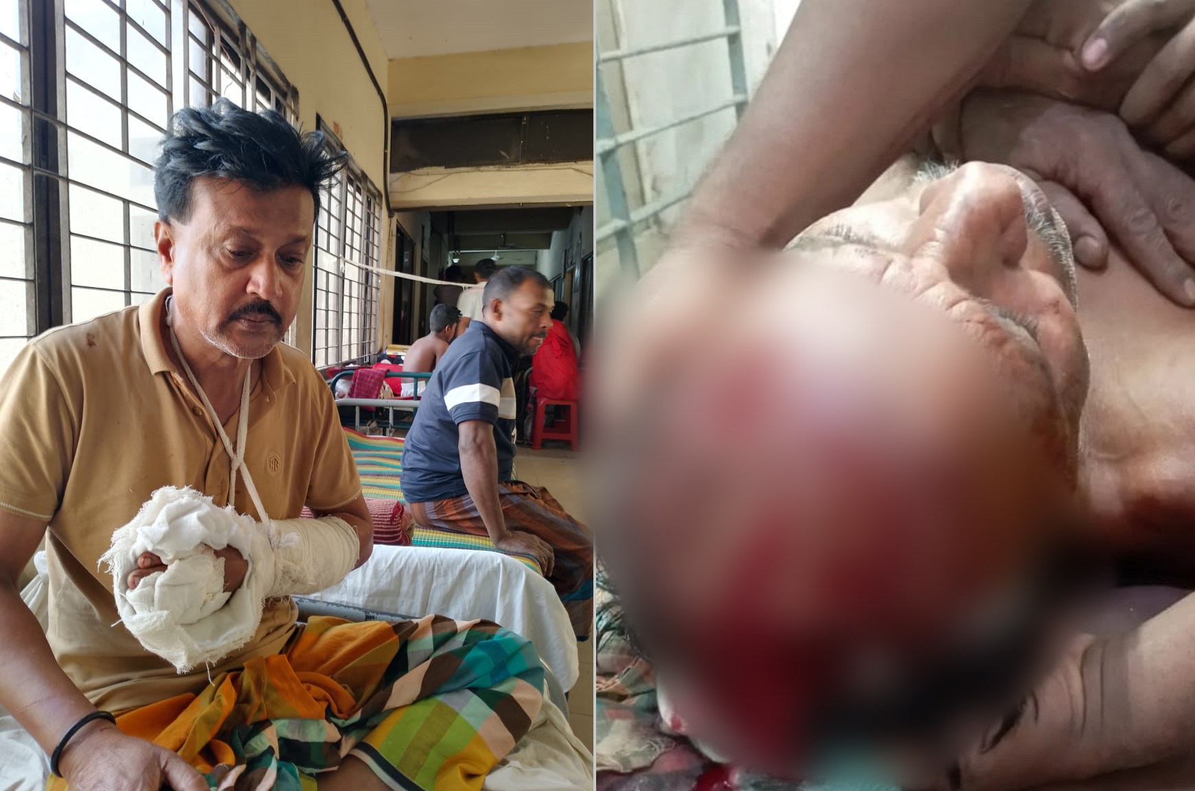 পূর্ব শত্রতার জের ধরে নাগরপুরে আওয়ামী সন্ত্রাসীদের হাতে জেলা জাসাস নেতাসহ ৬জন আহত