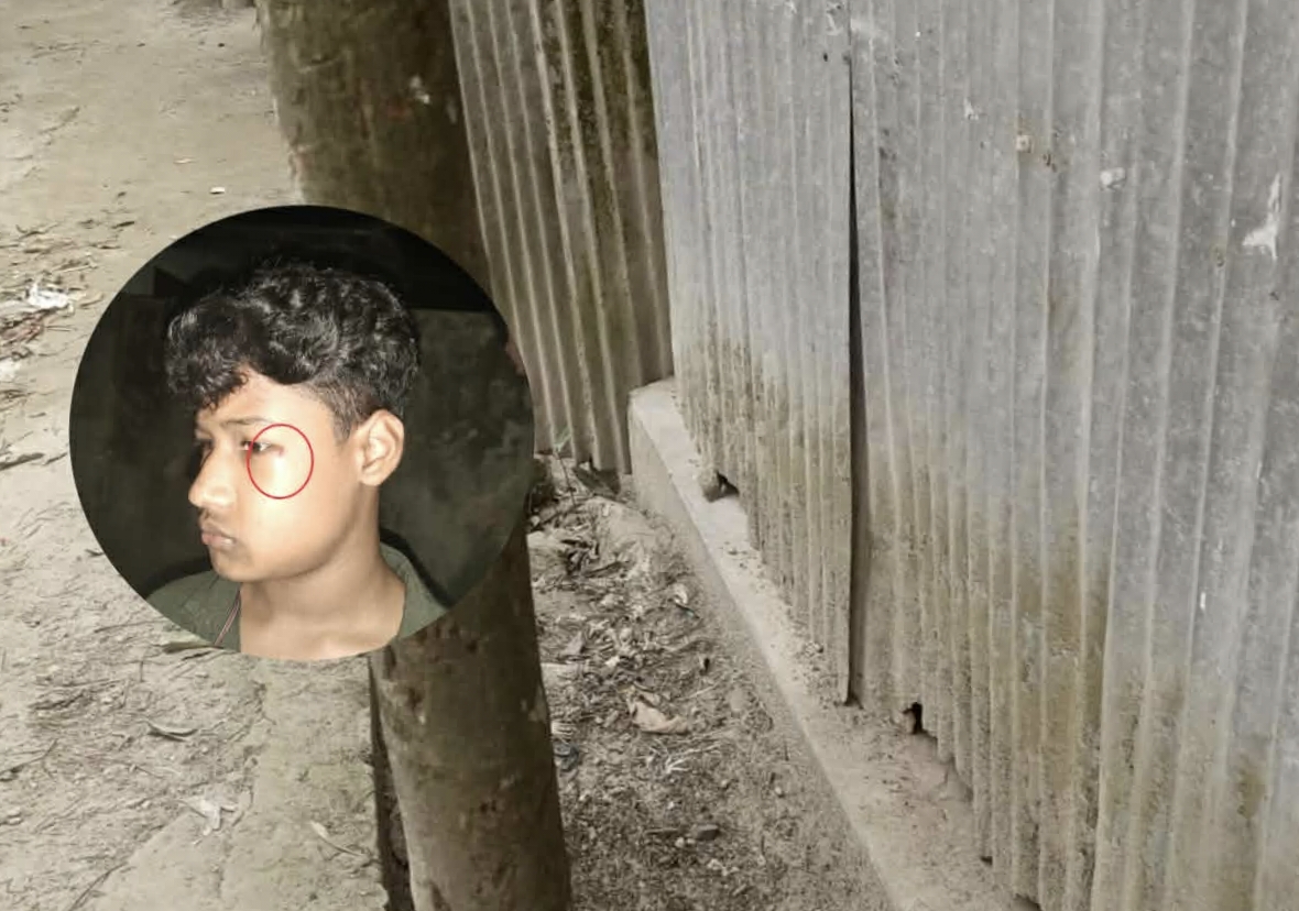 দেওয়ানগঞ্জে বাড়িতে হামলা, শিশুসহ আহত ৩